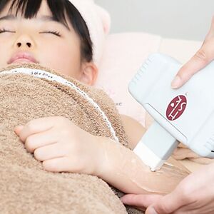 キッズ脱毛　ハイパースキン